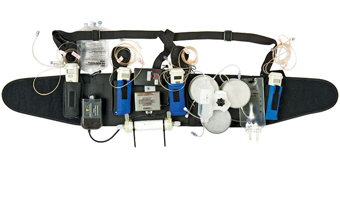 wearable artificial kidney