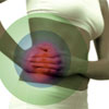 Kidney Stones