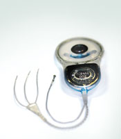 vestibular implant