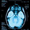 brain scan