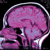 brain