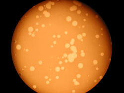 E. coli