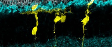 Glia cells and neurons in the retina, from an UW Medicine-led experiment on regeneration of retinal cells in mice.