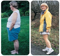 Left: Nancy Douglas before her bariatric surgery. Right: Nancy Douglas today, after losing more than 100 pounds of bodyweight. Photo by Kathy Sauber.