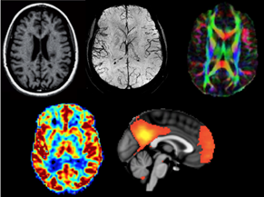 Diagnostic Imaging Sciences Center (DISC)