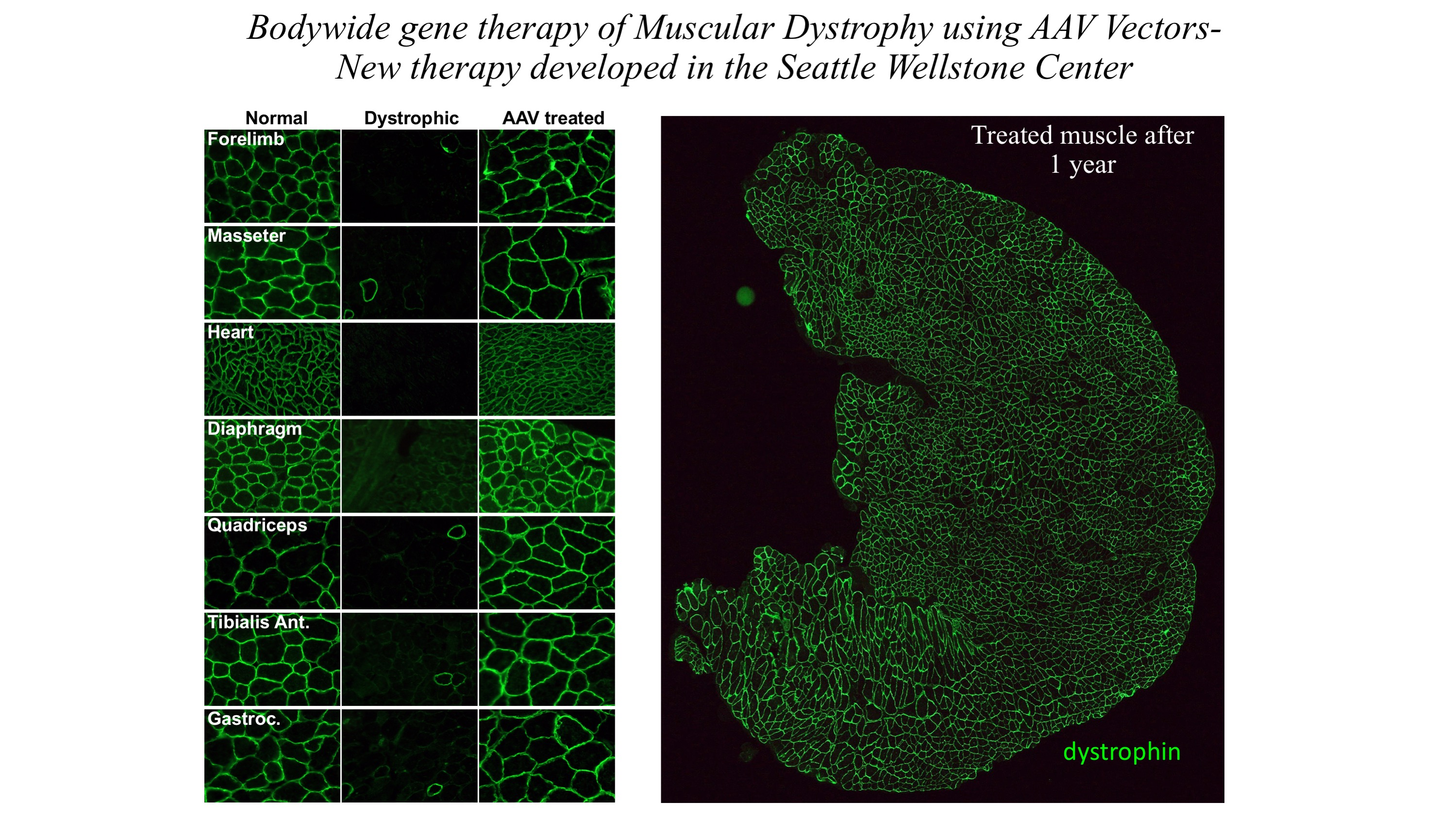 Wellstone - image of bodywide gene thereapy using AAV vectors - new therapy developed in the Seattle Wellstone Center
