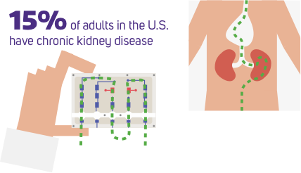 15% of adults in the U.S. have chronic kidney disease